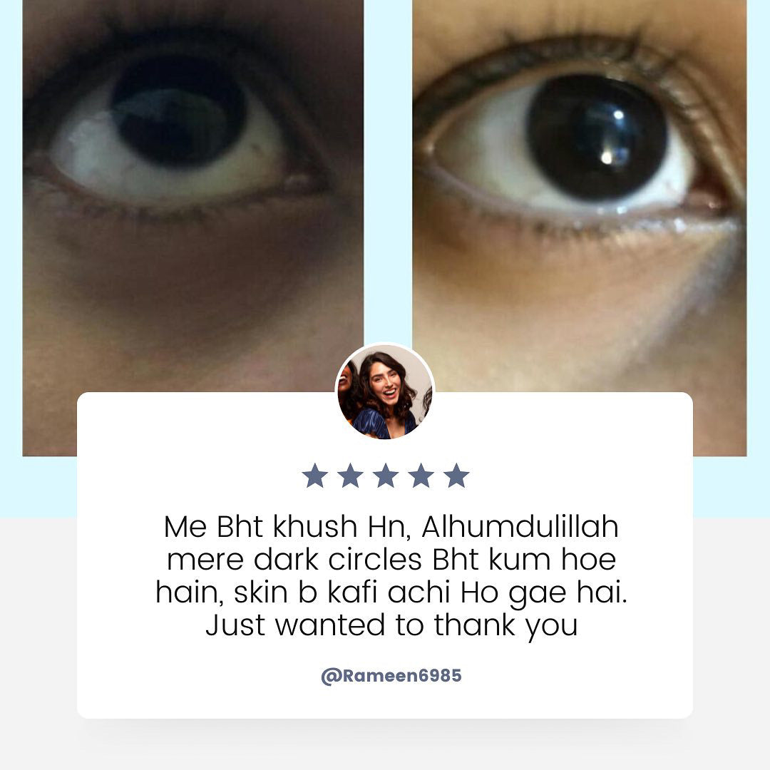 Light Undereye Serum