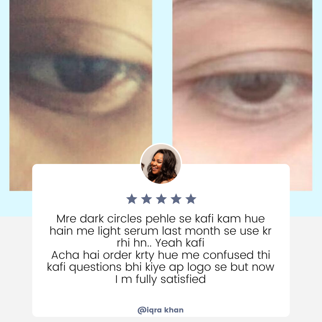Light Undereye Serum