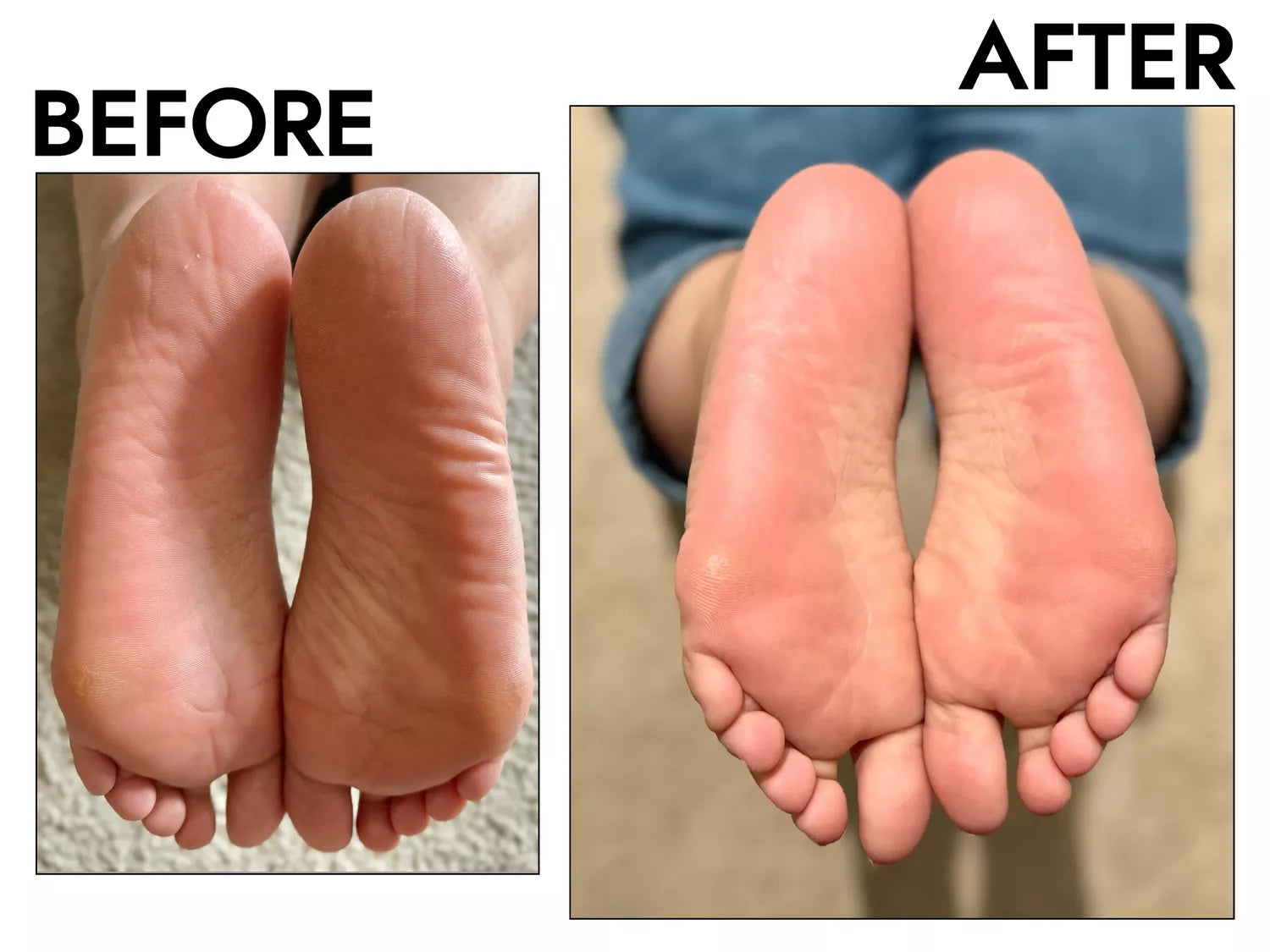 Soft & Smooth Feet Peel Mask